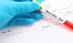 Beta HCG Hormonu Nedir? Heasplaması Nasıl Yapılır?